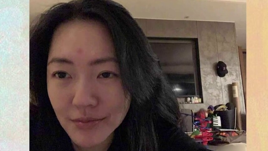 幽默风趣！小S晒被虫子咬后自拍照